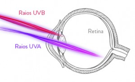 Dores nos olhos por uso de ring light com raios uv e luz azul violeta
